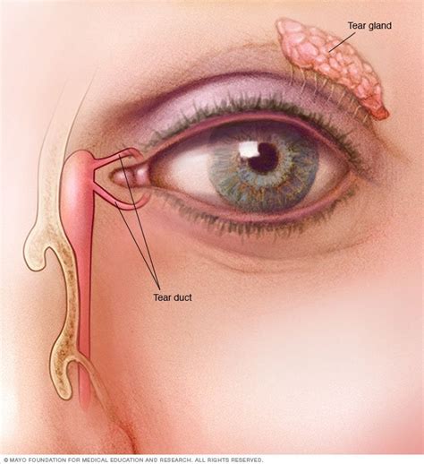 Blocked tear duct Disease Reference Guide - Drugs.com