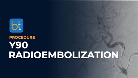 Y90 Radioembolization Procedure Prep | BackTable VI