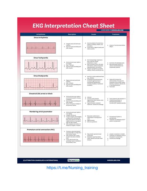Printable 12 Lead Ekg Interpretation Cheat Sheet - vrogue.co