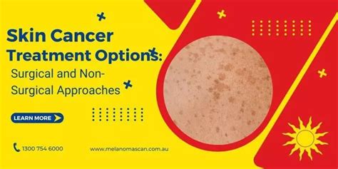 Skin Cancer Treatment | Melanoma Scan