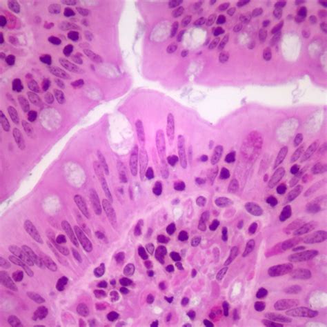 Histology Simple Columnar Epithelial Tissue Histology Slides Images ...