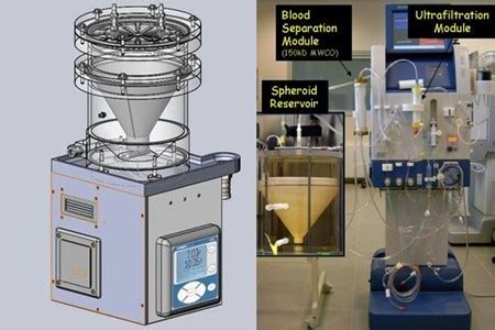 Mayo Clinic Tests Bioartificial Liver