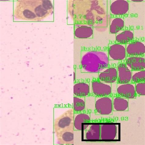 Renderings of NMS algorithm in different types of cells. The black... | Download Scientific Diagram