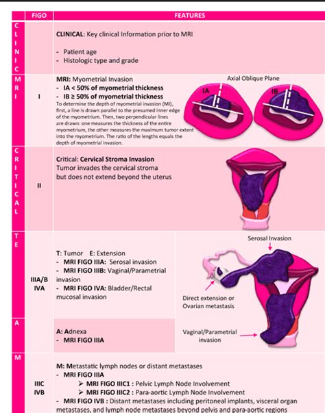 Endometrial Cancer MRI staging: Updated Guidelines of the European Society of Urogenital ...