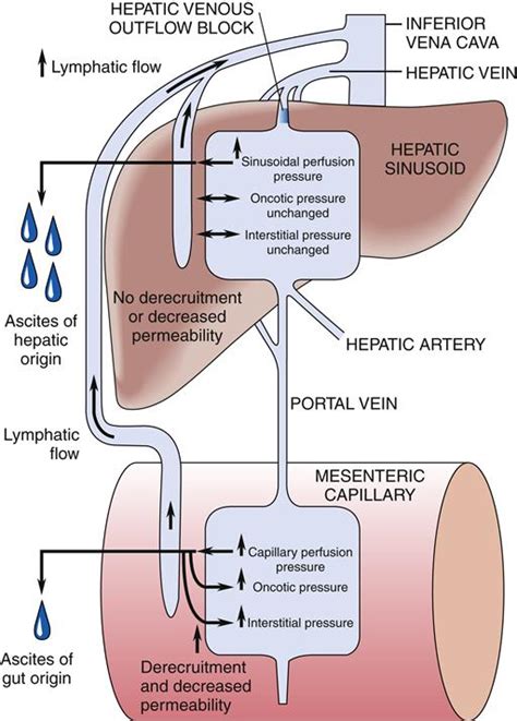 Liver Diseases | Basicmedical Key