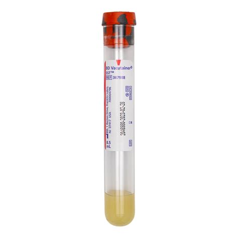 BD Vacutainer SST Tubes 16 x 100 mm 8.5mL Conventional Paper Label 367988