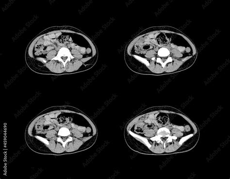 Abdomen ct scan and MRI professional images Stock Photo | Adobe Stock