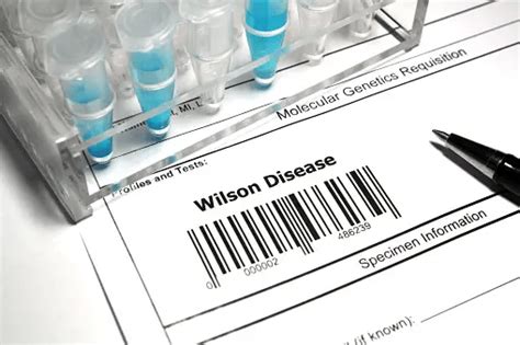 Wilson's Disease: Causes, symptoms, and natural remedies