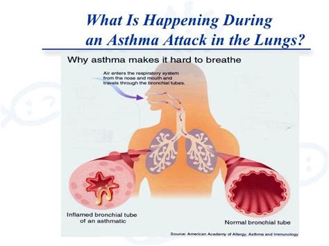 Does Asthma Cause Mucus In Chest - KnowYourAsthma.com