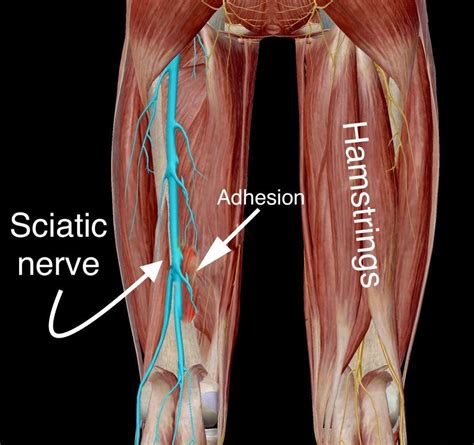 Sciatic Nerve Anatomy