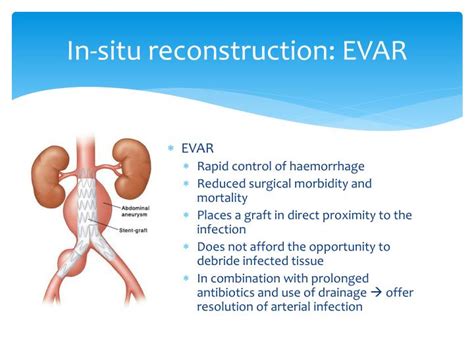 PPT - Review on Mycotic Aneurysm PowerPoint Presentation - ID:4894214