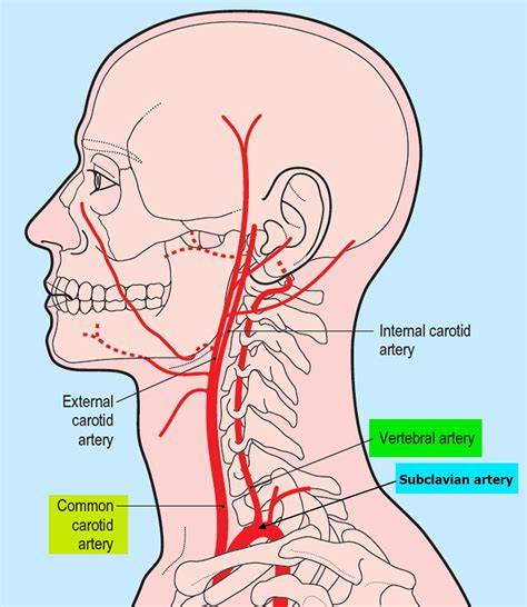 Vertebral artery dissection - Symptoms, Risk Factor, Treatment