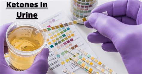 Ketones in Urine: Signs, Tests, And Results | MantraCare