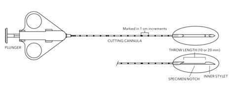 Quick-Core Biopsy Needles for Soft Tissue Biopsies | IZI Medical