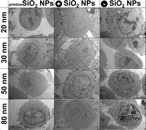 TEM images of alveolar A549 cells incubated in cell culture medium ...