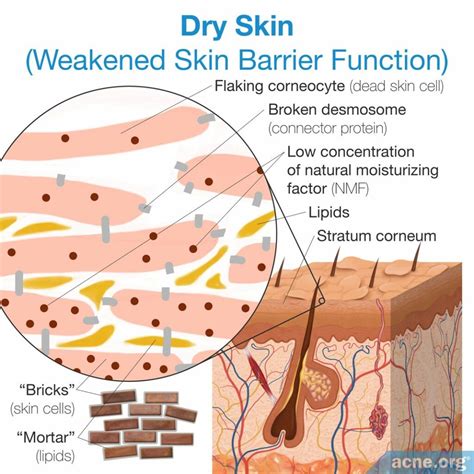 Dry Skin: Causes and Treatments - Acne.org