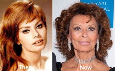 Sophia Loren Plastic Surgery Before and After - Latest Plastic Surgery Gossip And News. Plastic ...