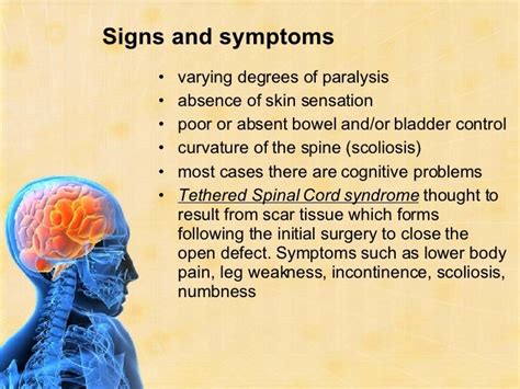 Neurological Disorders