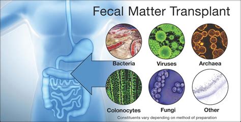 These days fecal transplantation is no joke | EurekAlert!