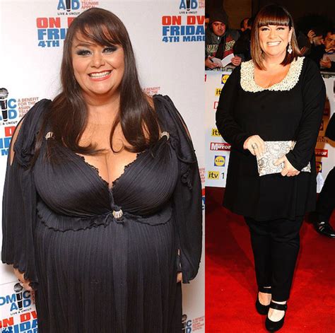 Dawn French Weight Loss - Lost Massive Seven and Half Stone - Healthy Celeb