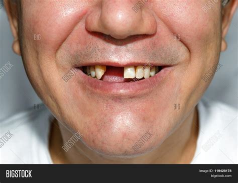 Man Smile Without Image & Photo (Free Trial) | Bigstock