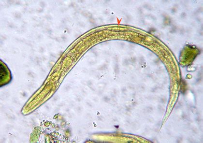 Strongyloides Stercoralis Filariform Larvae