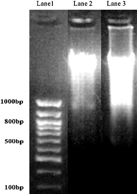 DNA fragmentation assay from bone marrow cells. Lane 1 = 100 bp ladder ...