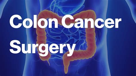 Empowering Recovery: Colon Cancer Surgery with Confidence