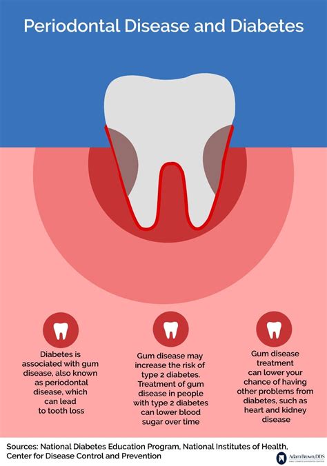 Gum Disease Treatment Monroe NC - Adam Brown DDS