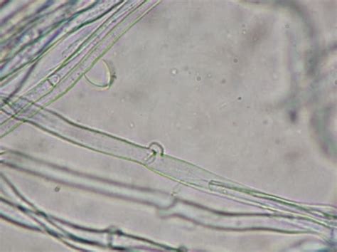 What is Mycelium? – Microscope Clarity