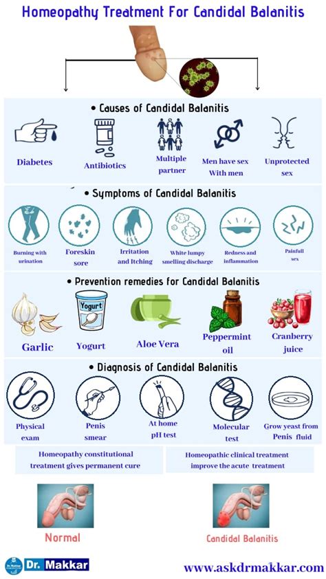 Sesión plenaria misericordia obesidad candida balanitis causes Hueso bancarrota idiota