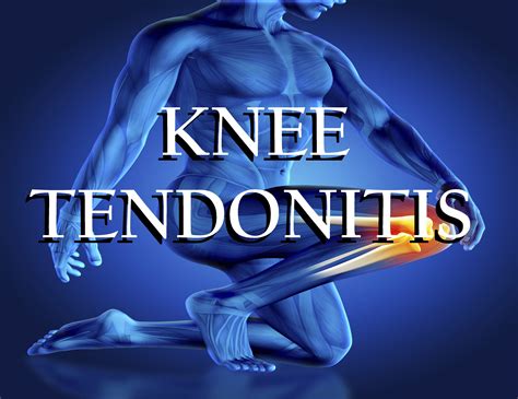 What is Tendonitis of the Knee?