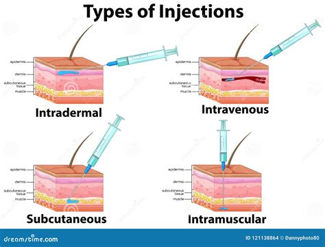 A Set of Type of Injections Stock Vector - Illustration of inject, clipart: 121138864