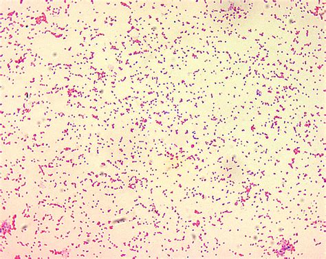 Free picture: brucella gram, negative, morphology