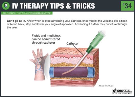 55 IV Therapy Tips and Tricks for Intravenous Nurses: The Ultimate Guide