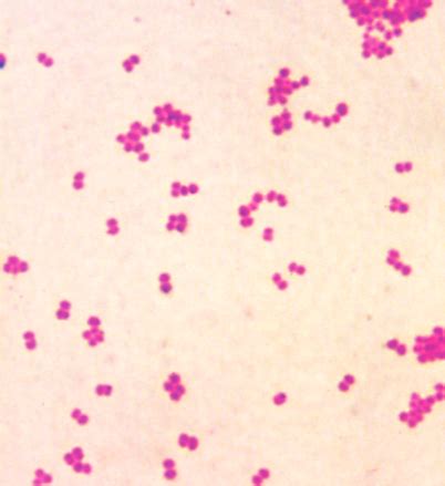 Neisseria Gram Stain