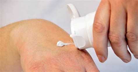 Prescription Steroid Cream for Eczema: What You Need to Know