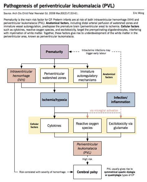 Cerebral palsy – McMaster Pathophysiology Review