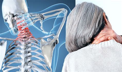 Arthritis: What are the symptoms you need to look for to identify neck ...