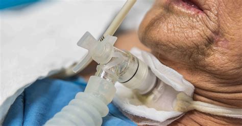 Advanced Airway Techniques Help Patients Breathe Easier