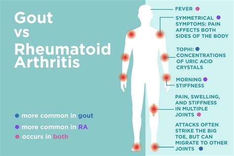 You Can Ease Inflammatory Arthritis Brain Fog with These 12 Tips for a Sharper Mind ...