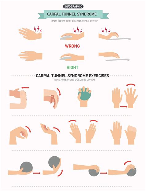 ecercise-therapy-Carpal-tunnel-syndrome-copy