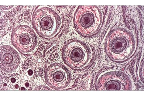 Hair Follicle Histology