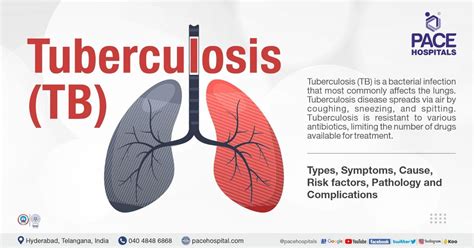 Tuberculosis - Symptoms, Types, Causes, Risk factors & Prevention