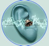 Tinnitus Relief