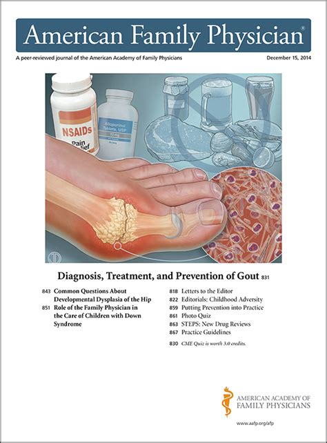 Gout Vs Pseudogout Crystals