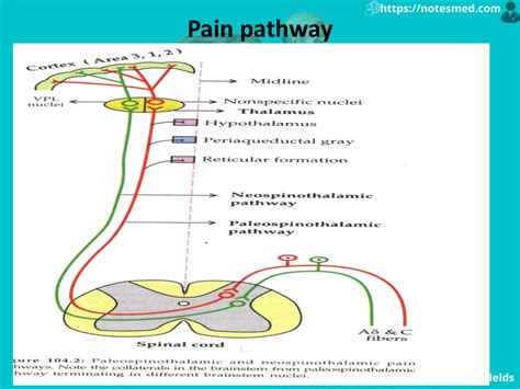 Physiology Of The Pain: Pathway, Types, Referred Pain | NotesMed