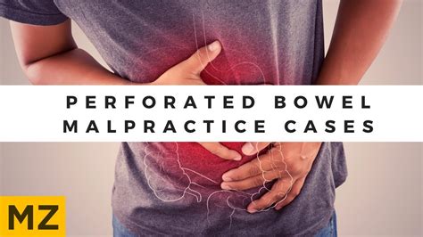 Perforated Bowel Malpractice Cases - YouTube