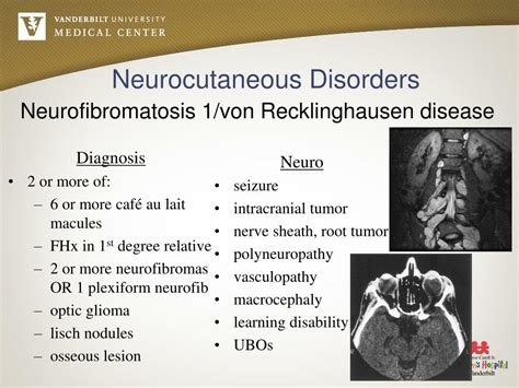 PPT - Neurocutaneous Disorders PowerPoint Presentation, free download - ID:4501574