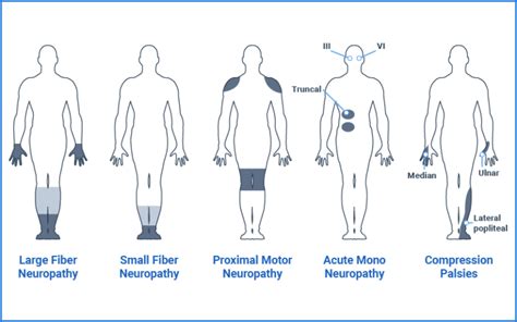 Peripheral Neuropathies - Tyrrell Physiotherapy